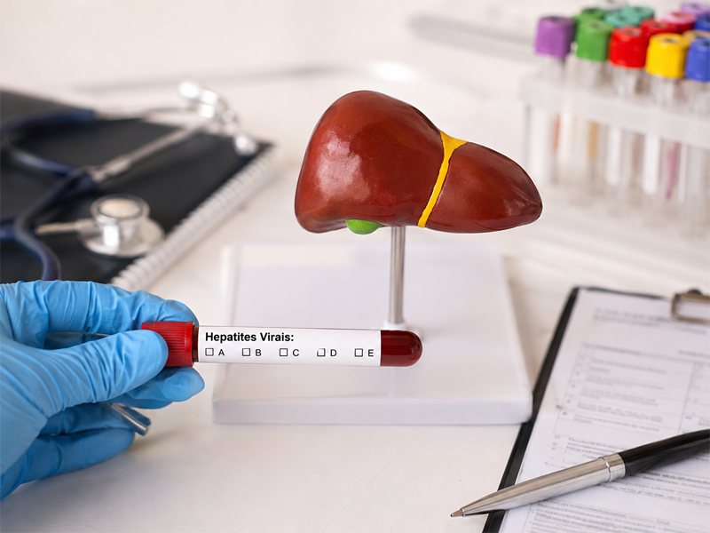 hepatites